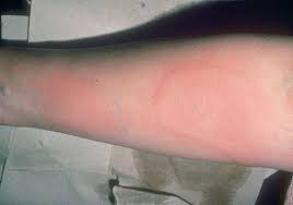 Image result for Wheal