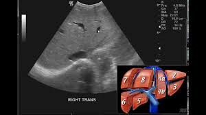 We did not find results for: Introduction To The Interpretation Of Abdominal Ultrasound Youtube