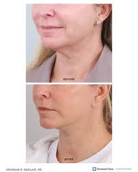 Cleveland Clinic Cosmetics and Aesthetics