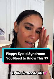 My Double Citronix Erika