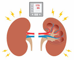 Hierbei liegen die werte stetig bei über 140/90 torr. Bluthochdruck Und Nieren Infothek Blutdruckdaten