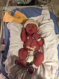 I got the 4 virus babies born at 25 weeks chance of survival. He S Here 35 4 Weeks March 2020 Babies Forums What To Expect Page 2