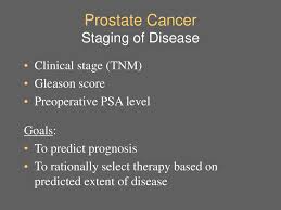 However, as with other types of cancer,. Dr Tak Hing Bill Wong Consultant Urologist Head Ppt Download