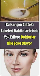 Pirinc Suyu Ne Ise Yarar Pirinc Suyu Maskesi Nasil Yapilir 2020 Cilt Rengi Organik Cilt Bakimi Ev Yapimi Cilt Bakimi