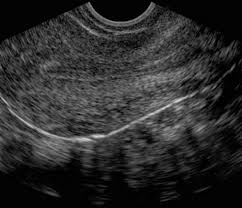 Maybe you would like to learn more about one of these? Aium Practice Guideline For The Performance Of Pelvic Ultrasound Examinations 2010 Journal Of Ultrasound In Medicine Wiley Online Library
