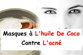7 Masques Naturels A L Huile De Coco Contre L Acne La Beaute Naturelle Masque Naturel Huile De Coco Acne Masque Huile De Coco