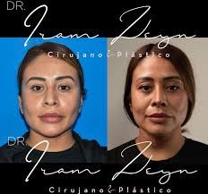 Sin saberlo, el hombre compone su vida de acuerdo a las leyes de la  belleza, aún en momentos de mas profunda desesperación.