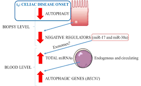 Your current browser isn't compatible with soundcloud. Ijms Free Full Text Identification Of Autophagy Related Genes And Their Regulatory Mirnas Associated With Celiac Disease In Children Html