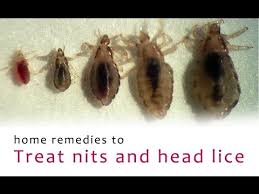 Applying olive oil can make your hair wet and silk. Howto How To Get Rid Of Lice Eggs In Hair Fast At Home