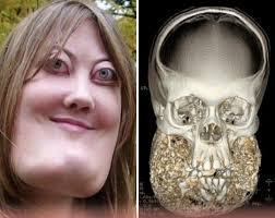 Remembering former child actress with disability