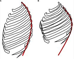 The holy saint's corpse is the main driving plot of part 7 of jojo's bizarre adventure that the steel ball. Schematic Images Of Rib Cage The Shape Of The Rib Cage After Lateral Download Scientific Diagram