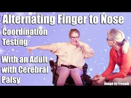 Image result for Finger-Nose-Finger Test