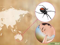 Many of the symptoms of a black widow bite can look like those of other conditions. 3 Ways To Treat Spider Bites Wikihow