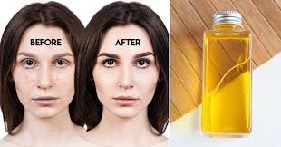 Argan oil is a common ingredient in many cosmetics owing to the incredible ability to rejuvenate and restore. Top 5 Moroccan Argan Oil Benefits For Hair Face And Skin Biotyful Net Argan Oil Benefits Argan Oil Oil Benefits