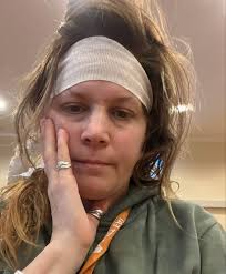 חשד לתקיפה על רקע אטנישמי בברלין: סולי, ישראלית תושבת העיר, הותקפה בערב  השנה החדשה בצורה חמורה