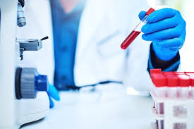 Calcitonin can be used to detect thyroid cancer in early stages. A Simple Blood Test That Detects Cancer And Diabetes Complications Docwire News