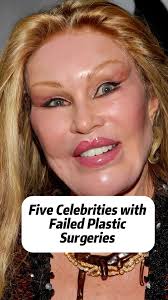 Heidi Montag Surgery Episode