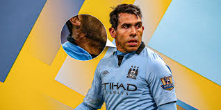 How Carlos Tevez got his Neck Scar