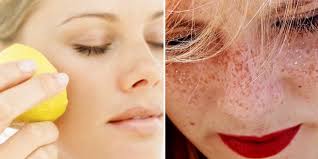 как сделать лицо чистым и гладким в домашних условиях Kak Sdelat Kozhu Lica Idealnoj