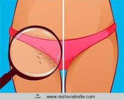 Having an infected ingrown hair is most commonly caused by shaving or waxing your arms, chest, back, pubic area, legs, face, and underarms. How Long Does An Ingrown Hair Last Cases Symptoms Treatments