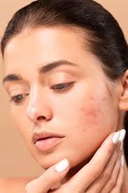 Dermatitis En Los Parpados Causas Y Remedios Naturales