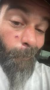 How to install Severe Duty Steering Rack