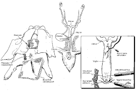 Quick, no pain, local anesthesia, home the same day. Schematic Diagram Showing Rabbit Female Genitalia And Experimental Download Scientific Diagram