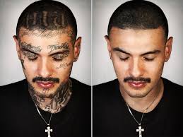 How To Remove Tattoos In Photoshop Tutorial Tattoo Removal Tattoo Removal Cost Laser Tattoo