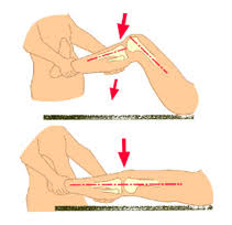 Image result for Pivot Shift Test