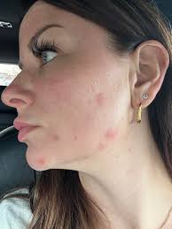 It's taken me sooooo long to get cut in my shoulders and back! I'm the  leanest I've ever been and I'm starting to feel like my back finally has  more muscles than