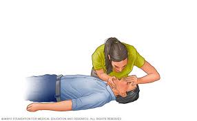 We did not find results for: Cardiopulmonary Resuscitation Cpr First Aid Mayo Clinic
