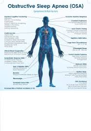 Symptoms Of Sleep Apnea Chart Sleep Apnea Snoring