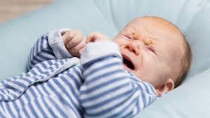 Breath Holding Spells Diseases And Conditions Pediatric Oncall
