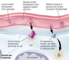 Type 1 Diabetes Mellitus Harvard Health