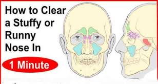 Then exhale all of your air. How To Clear Your Stuffy Nose In 1 Minute Stuff Nose Remedies Stuffy Nose Stuffy Nose Remedy