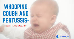 Whooping cough typically progresses through three stages. Whooping Cough And Pertussis Vaccine Know What It Is Seymourems