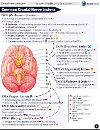 Image result for Neurologic Lesion Localization