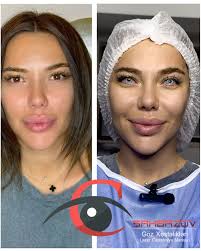 The first photo was taken