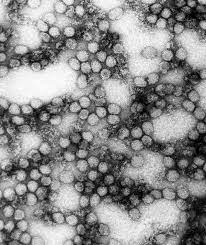 La enfermedad aparece normalmente en brotes en las regiones tropicales del áfrica subsahariana. Yellow Fever Wikipedia