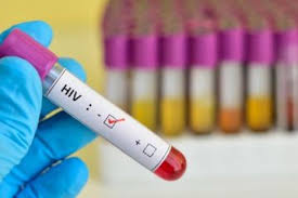Beberapa gejala dan tanda penyakit akibat infeksi virus hiv pada tubuh manusia dapat muncul dan dirasakan oleh tubuh odha (orang dengan hiv aids) bahkan ketika virus baru beberapa bulan menginfeksi tubuh. Gejala Hiv Pada Kulit Terbentuk Adanya Ruam Yang Disertai Gejala Flu Juga Pembengkakan Kelenjar Getah Bening Semua Halaman Intisari
