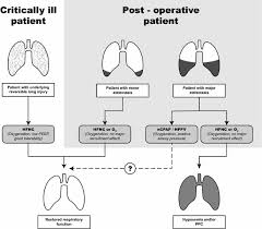 Adult, nasal cannula with straight prongs and tube, 5m. High Flow Nasal Cannula In The Postoperative Period Is Positive Pressure The Phantom Of The Opera Trial Springerlink