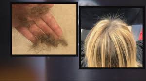 Hundreds Across The Country Say Monat Shampoo Caused Balding Scalp Sores