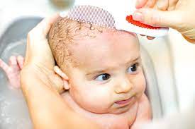 Ab wann kommt der milchschorf? Milchschorf Und Kopfgneis Ist Mein Baby Krank Medizinisches Baby Swissmom Ch
