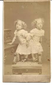 Joyce warren, jane blazek, william blazek, robert blazek. Anaesthetised On Twitter The Conjoined Sisters Rosa Josepha Blazek Were Born In Skrejsov Bohemia On Jan 20 1878 The Two Were Pygopagus Joined At The Posterior Https T Co 2djtwthtwv