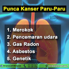 Kanker ini lebih banyak dialami oleh orang yang memiliki kebiasaan merokok dan merupakan satu dari tiga jenis. Punca Kanser Paru Paru 1 Merokok Xtransscell Malaysia Facebook