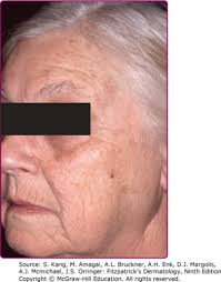 Unit 11 (pharmacology) Flashcards