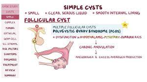 There are several types of ovarian cysts, and they can occur during pregnancy, menopause, and postmenopause. Ovarian Cysts And Tumors Pathology Review Osmosis