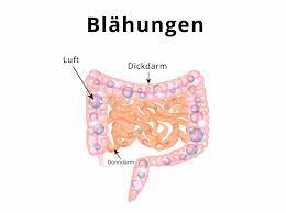 Blahungen