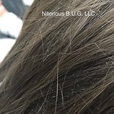 Does Your Client Have Lice This Is What To Do Behindthechair Com Hair Nits Long Hair Styles Louse