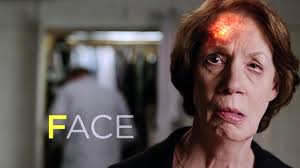 Be Fast to diagnose strokes, say family of man who died in A&E